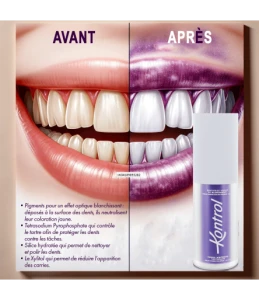 Kontrol Dentifrice De Blanchiment Correcteur De Couleur Violet T/30ml